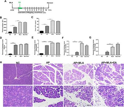 Electroacupuncture Ameliorates Acute Pancreatitis: A Role for the Vagus Nerve–Mediated Cholinergic Anti-Inflammatory Pathway